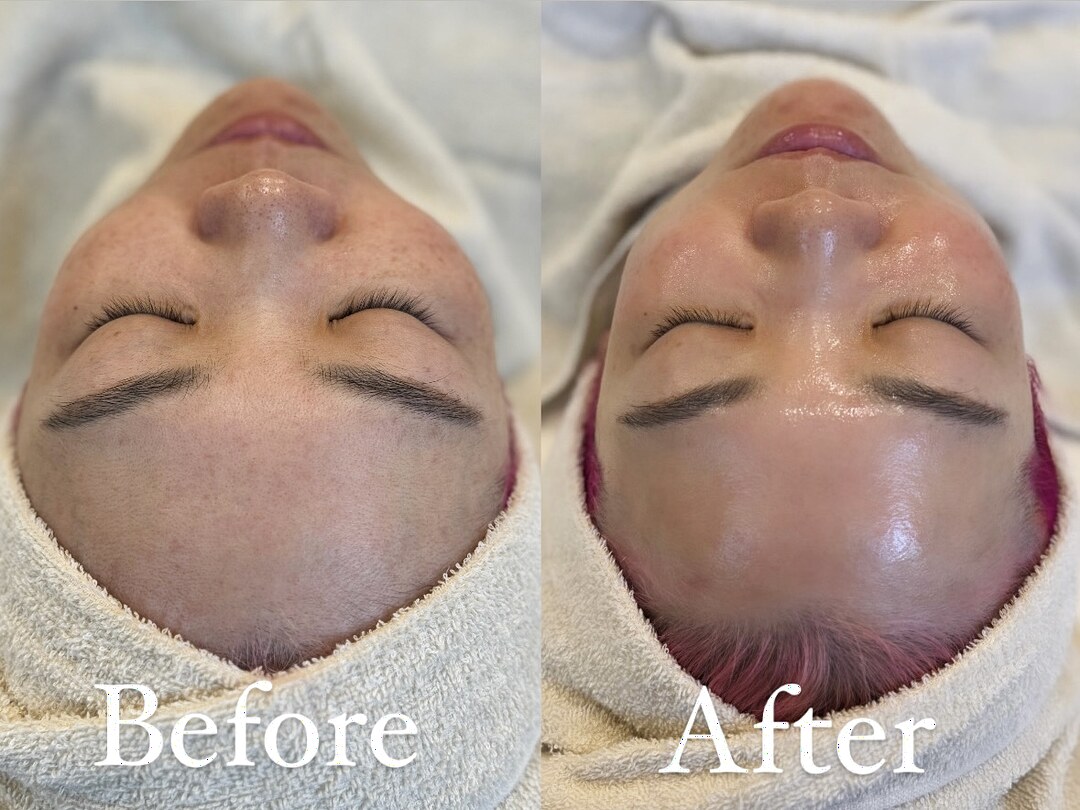 韓国肌管理のビフォーアフター